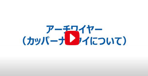 アーチワイヤー（カッパーナイタイ）　ご紹介