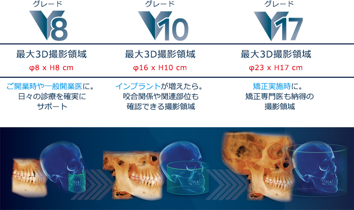 グレードは３タイプ。いつでもアップグレードが可能