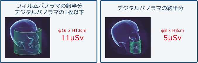 新しい撮影モード「Quick Scan＋」では更なる線量の低減に成功