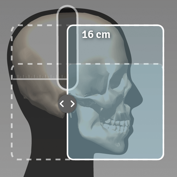 OP 3D 側方セファロ撮影および小児セファロ撮影