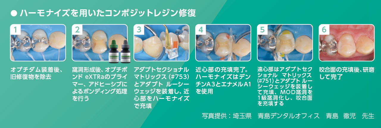 OptiBond™ eXTRa - Composition