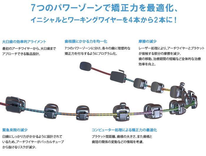 7つのパワーゾーンで矯正力を最適化、イニシャルとワーキングワイヤーを4本から2本に！
