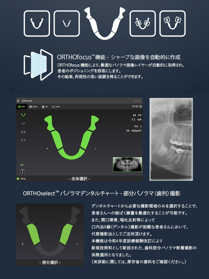 ORTHOfocus™ 機能とORTHOselec™ 機能