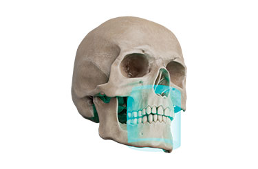FOV Φ8 × H8cm FOV Φ8 × H8cm
