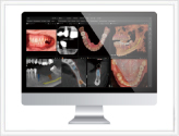 DTX Studio™ Clinic<br>ソフトウェア